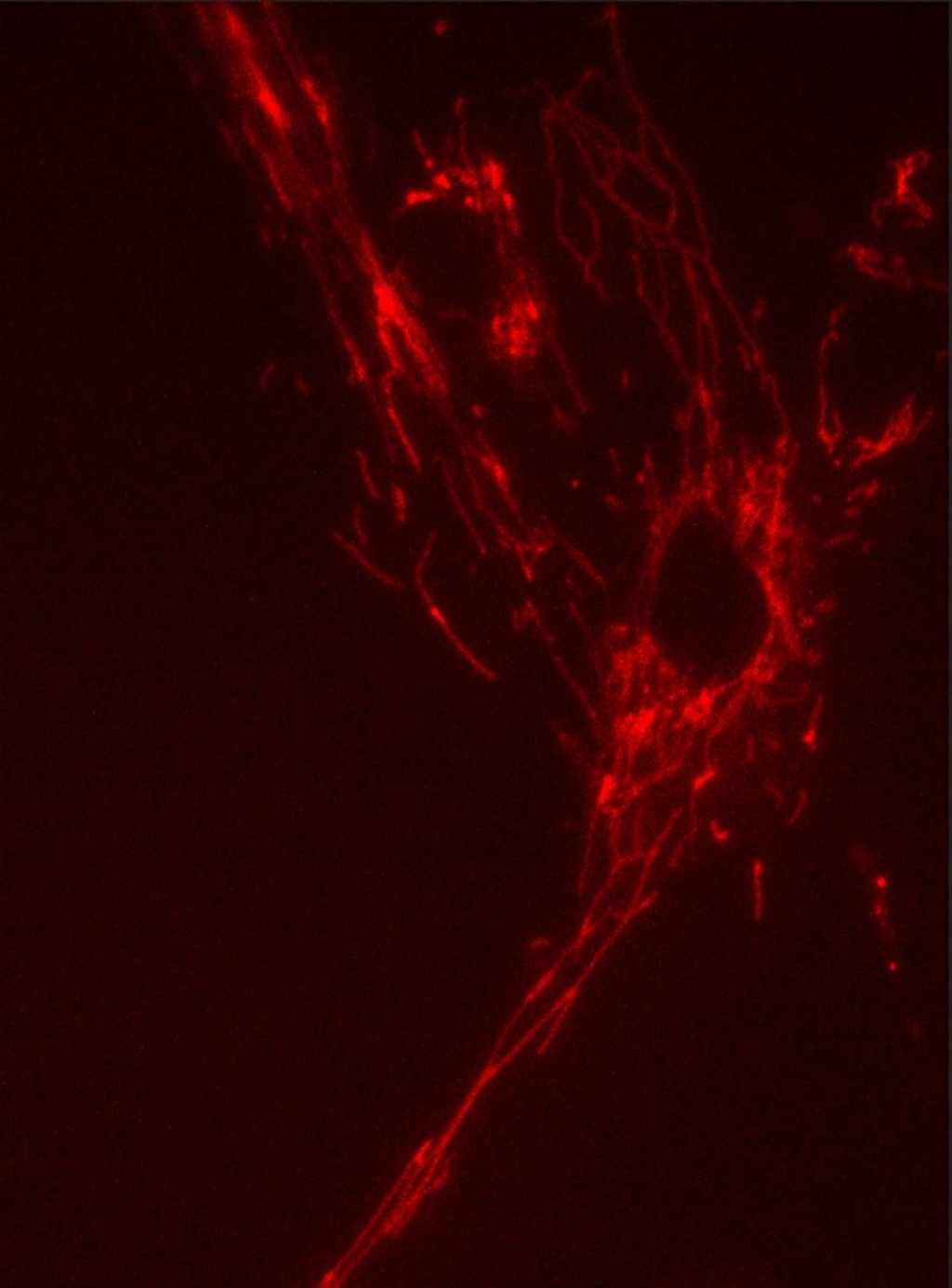 A human myoblast with mitoQc reporter